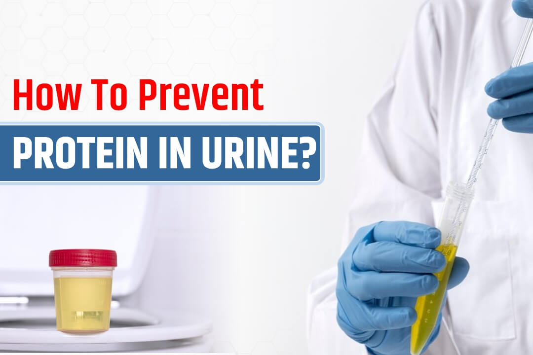 How To Prevent Protein In Urine